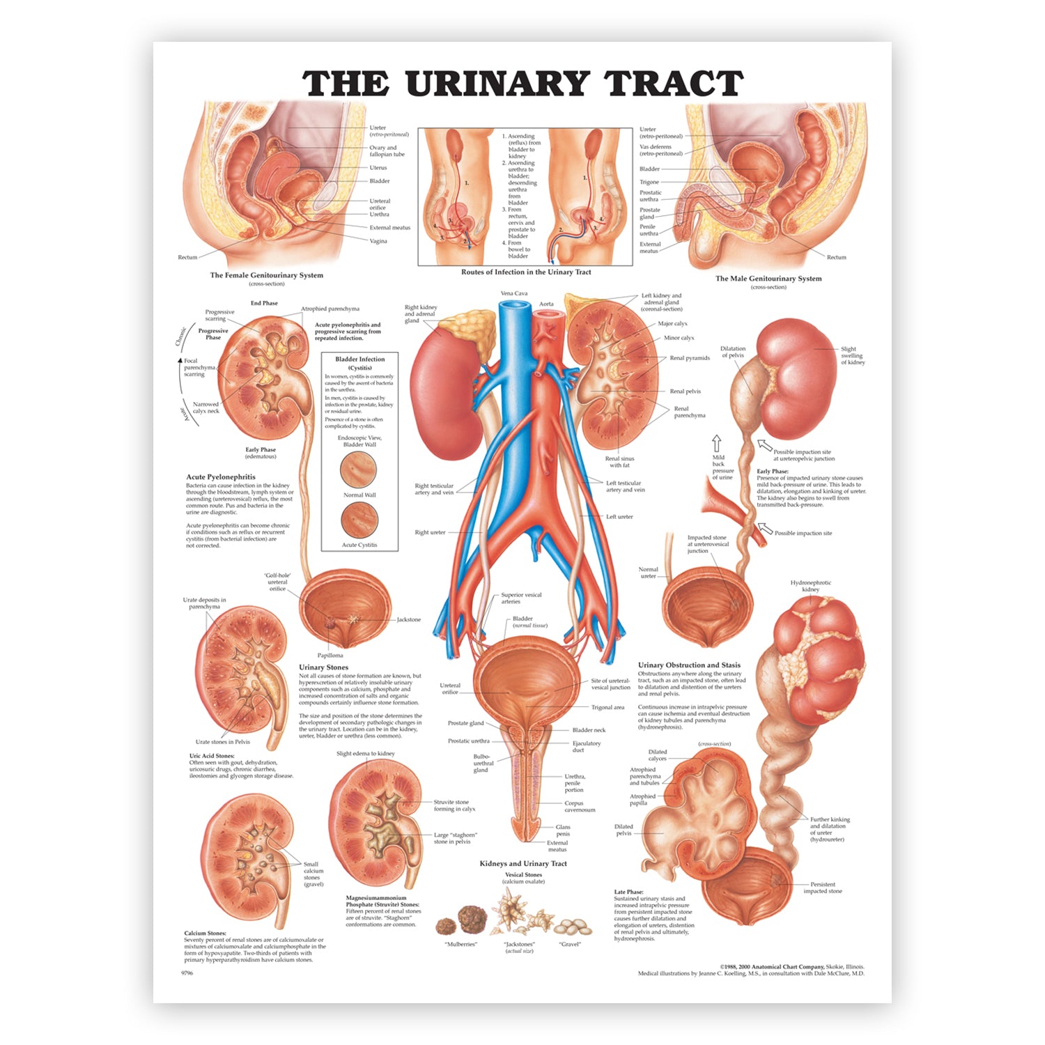 Plakater om nyrer og urinvejene