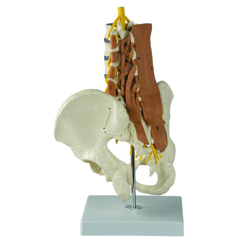 Model af lænden med spinalnerver og muskler samt bækkenet