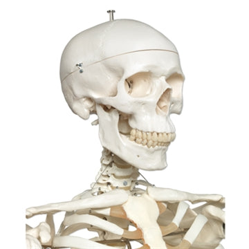 Extra robust skelett gjutet i kraftigt plastmaterial