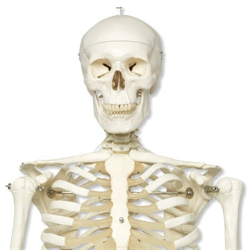 Extra robust skeleton cast in strong plastic material