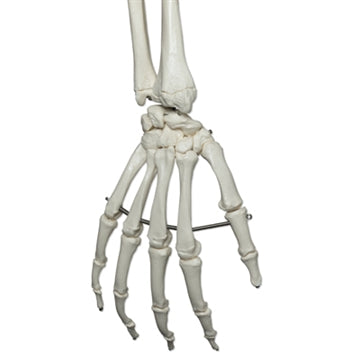 Extra robust skeleton cast in strong plastic material