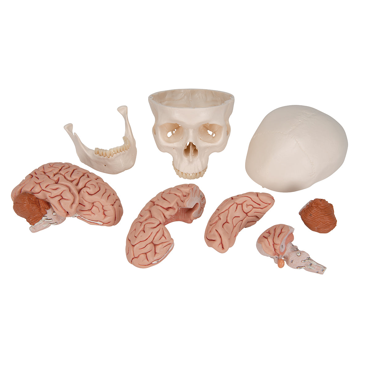5-part brain model in skull