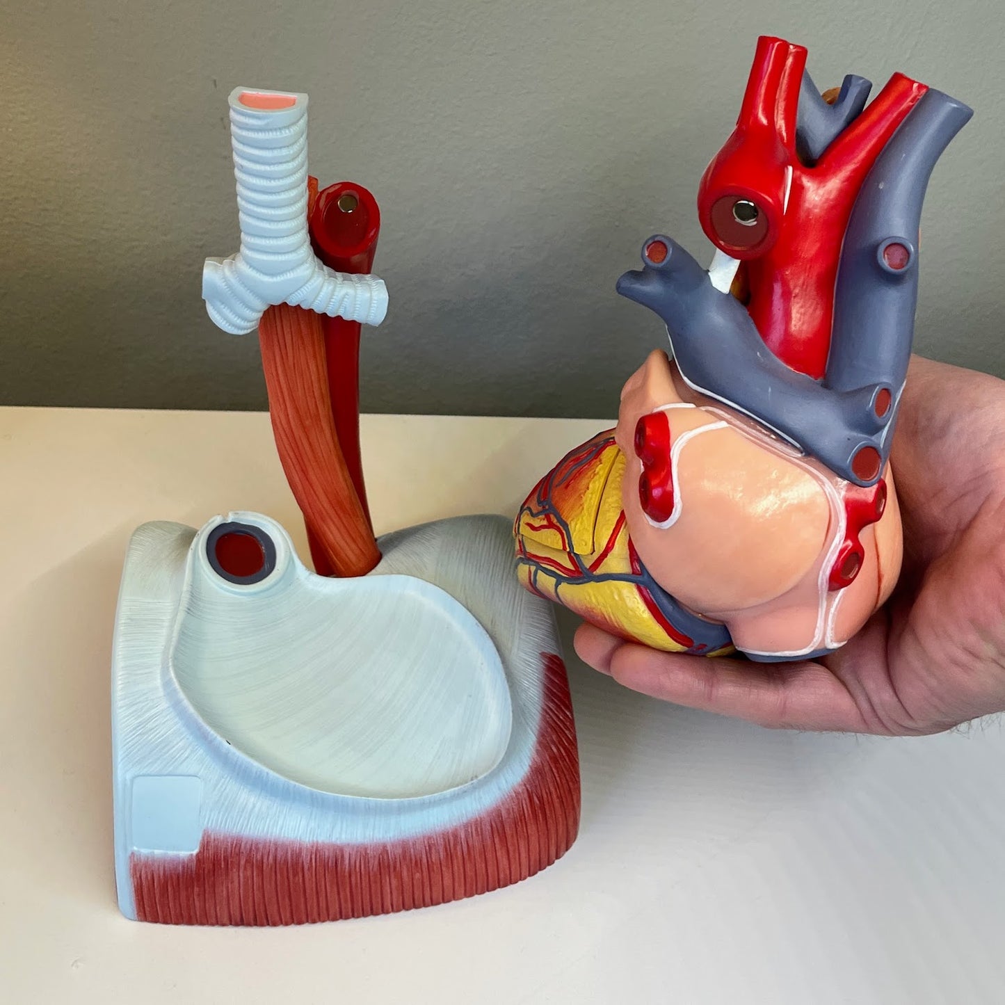 Enlarged heart model in high quality and 12 parts