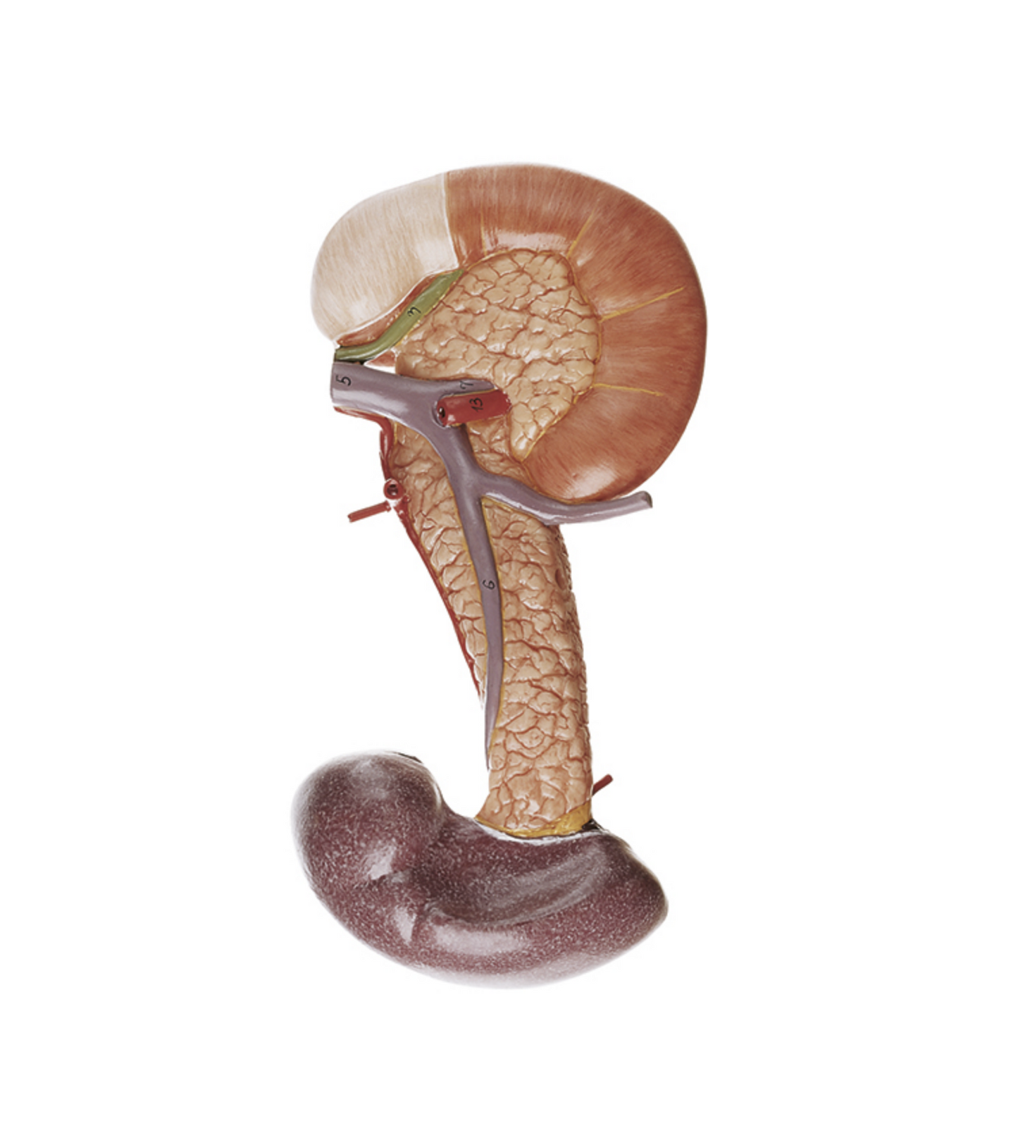 Modell av bukspottkörteln med mjälte och duodenum