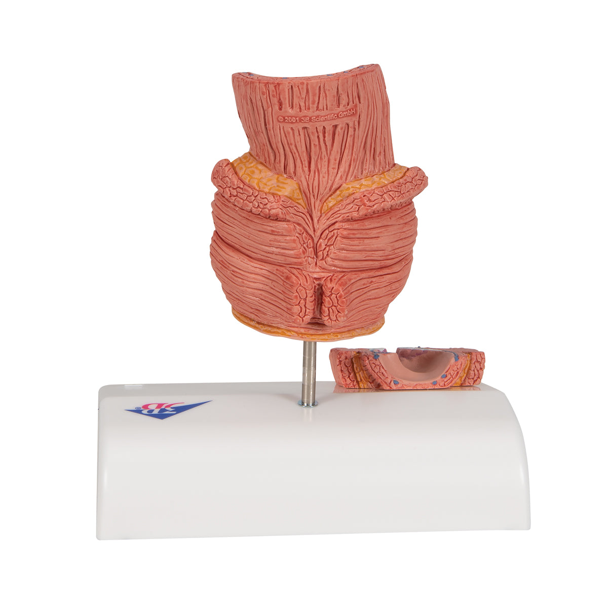 Model of the rectum showing hemorrhoids