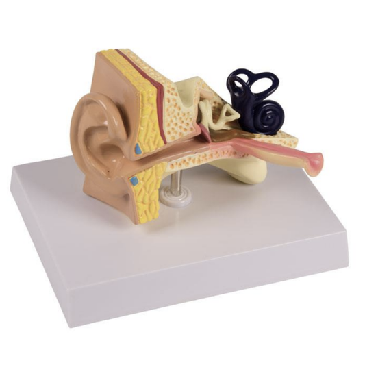 Ear model of a child's ear showing otitis media