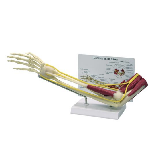 Elbow model with muscles and nerves as well as forearm and hand