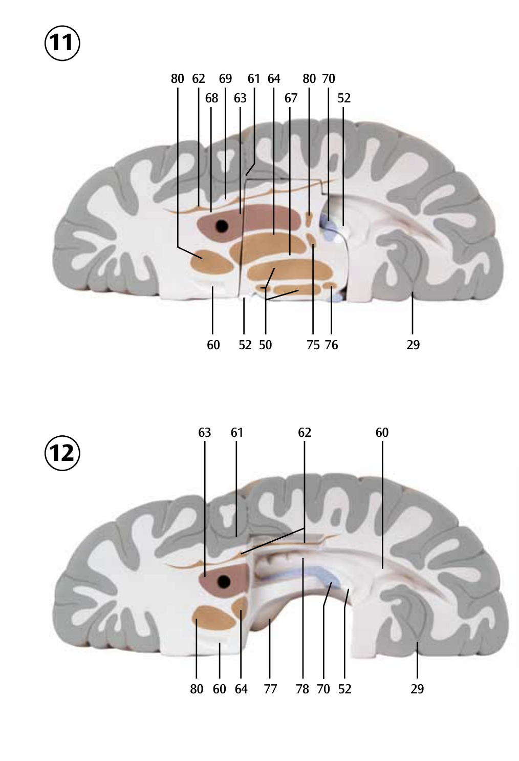 Giant brain model in 14 parts