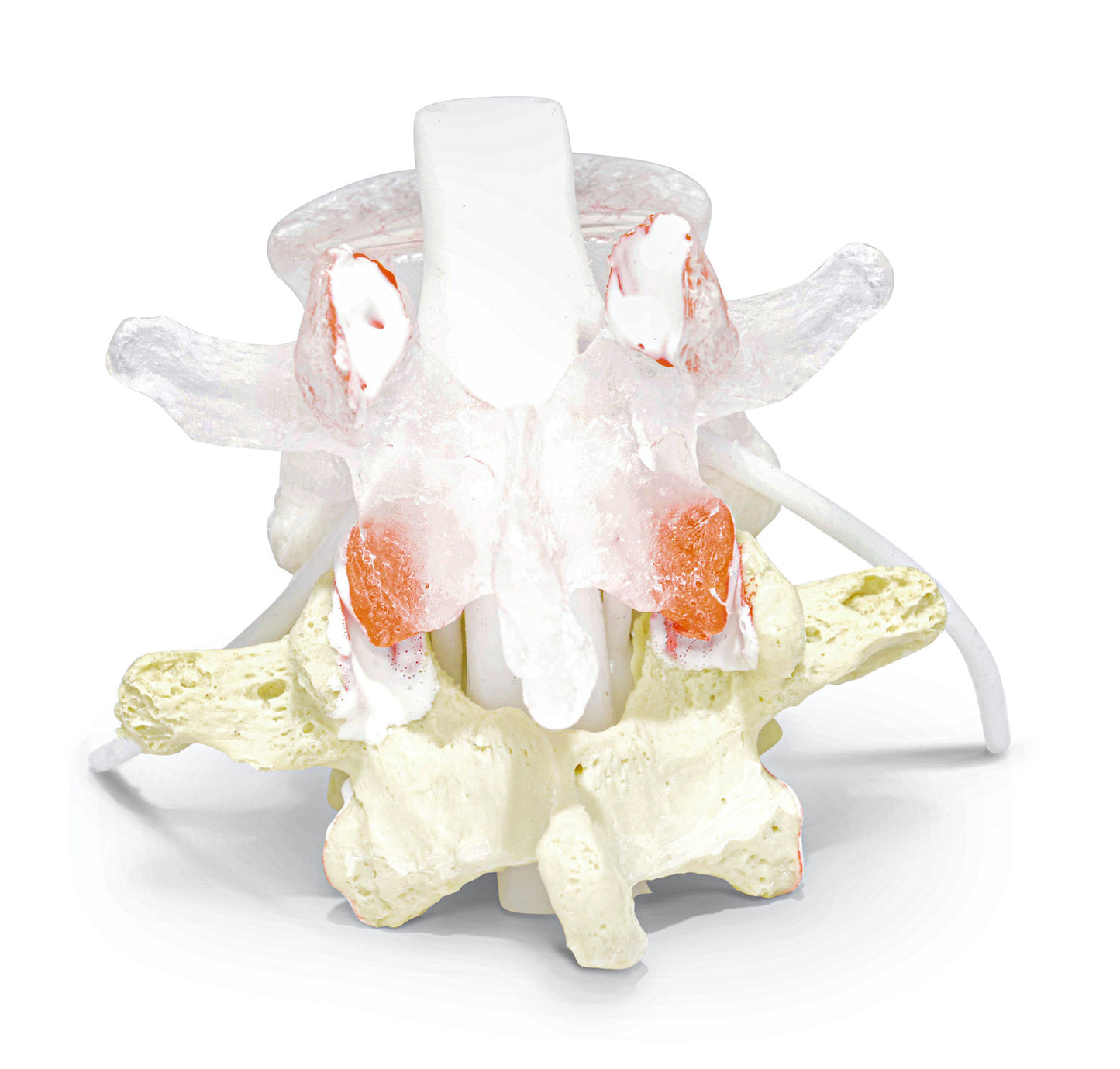 Dynamic spine model of 2 lumbar vertebrae showing a herniated disc. Extra learning-friendly