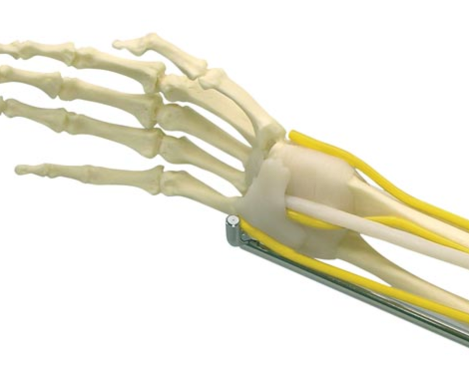 Armbågsmodell med muskler och nerver samt underarm och hand