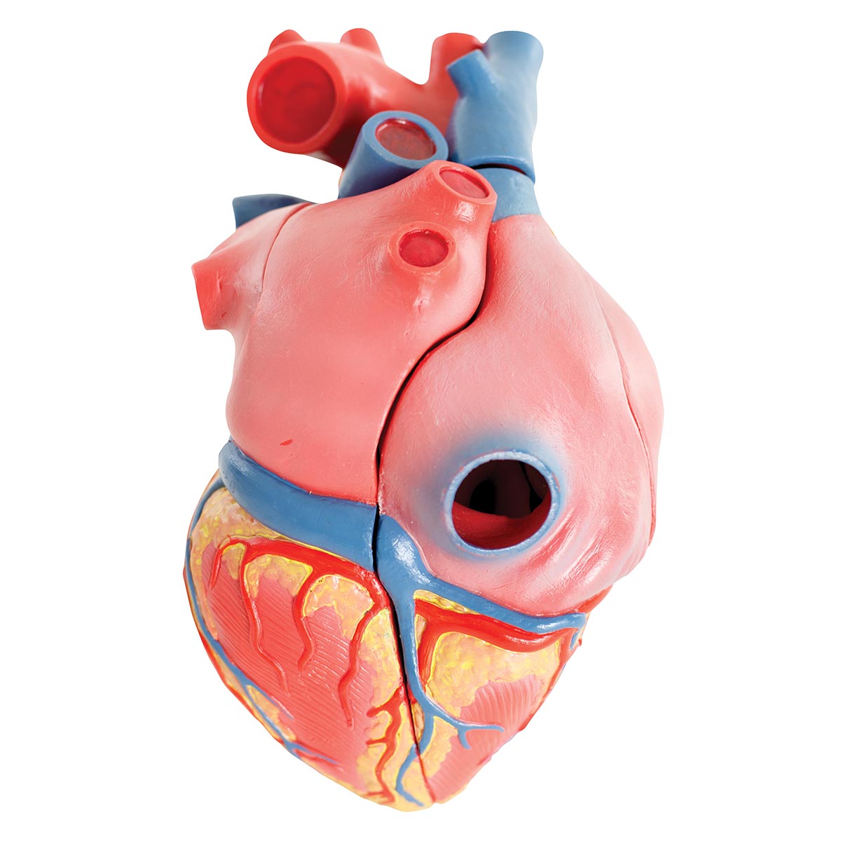 Hjärtmodell med fokus på de 4 hjärtklaffarna och gips efter ett riktigt hjärta