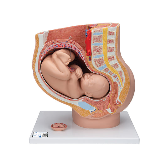 Bækkenet med et foster i 40. graviditetsuge og et supplerende foster i 3. graviditetsmåned. Kan adskilles