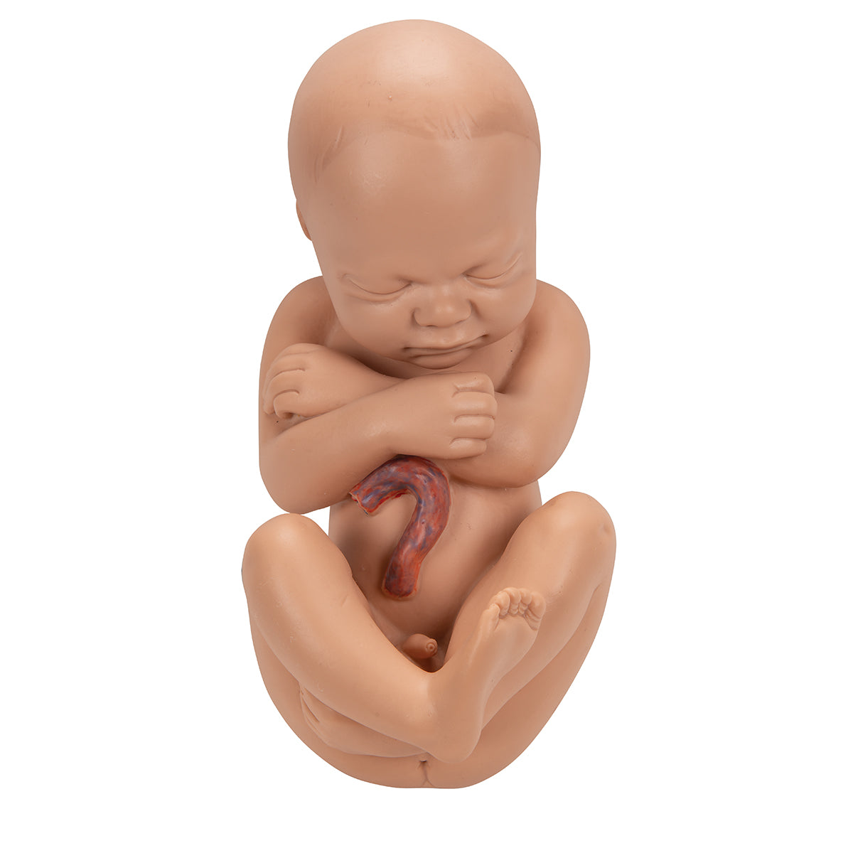 Bäckenet med ett foster i den 40:e graviditetsveckan och ett ytterligare foster i den 3:e graviditetsmånaden. Kan separeras
