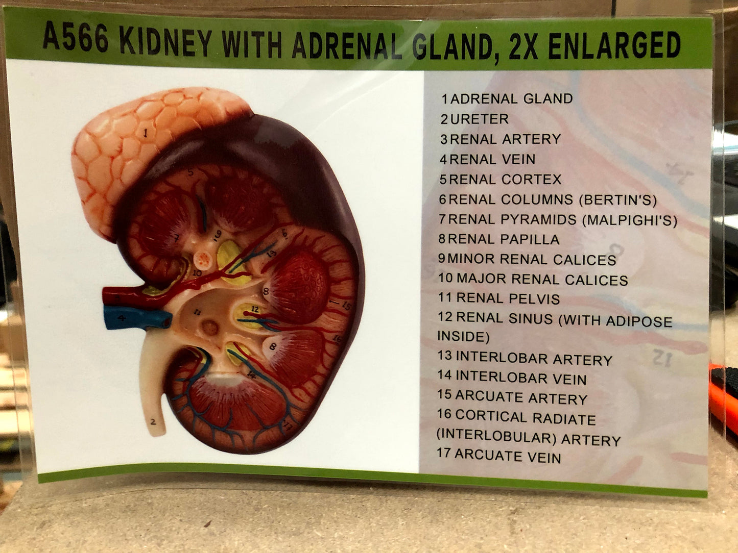Enlarged kidney model incl. the adrenal gland showing a longitudinal section of the kidney