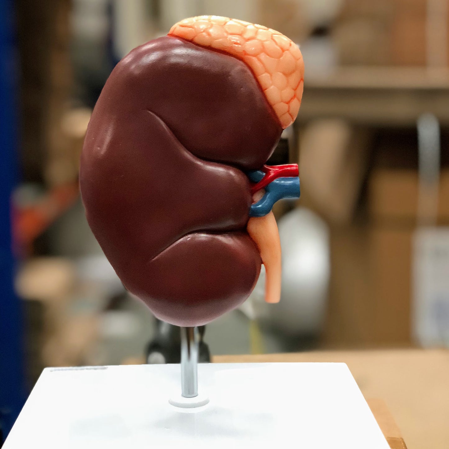 Enlarged kidney model incl. the adrenal gland showing a longitudinal section of the kidney