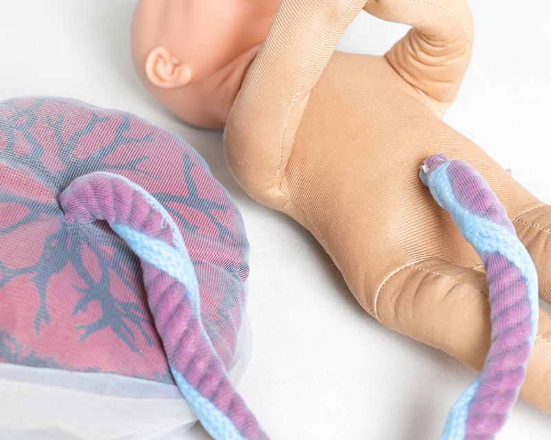 Fetal doll with placenta and umbilical cord as well as visible chorion and amnion