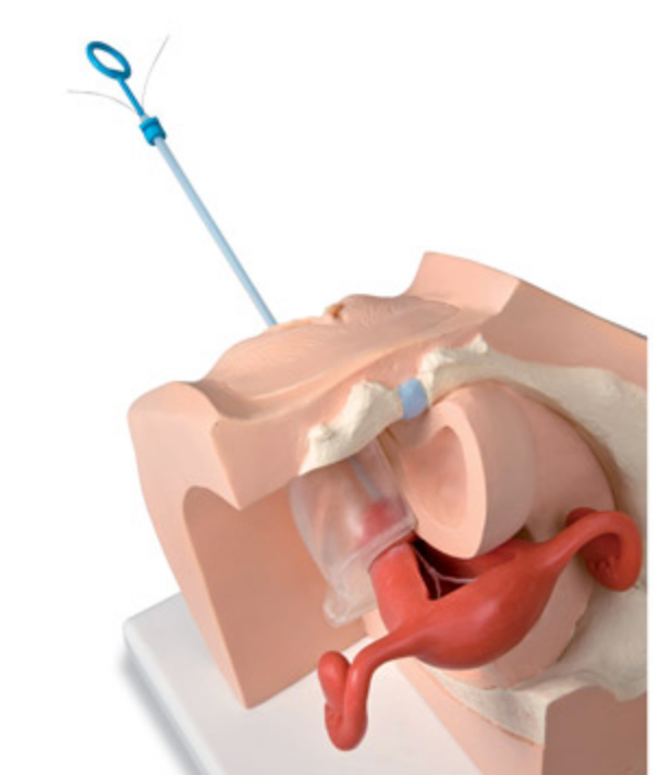 Gynecological training model for inserting contraceptives
