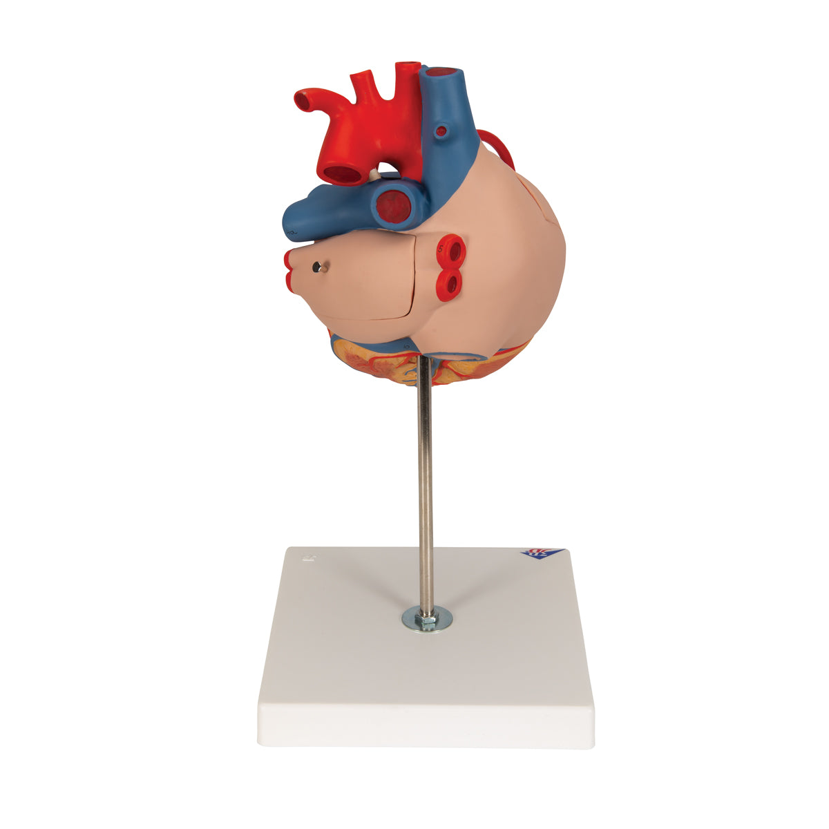 Enlarged heart model showing the result after bypass surgery