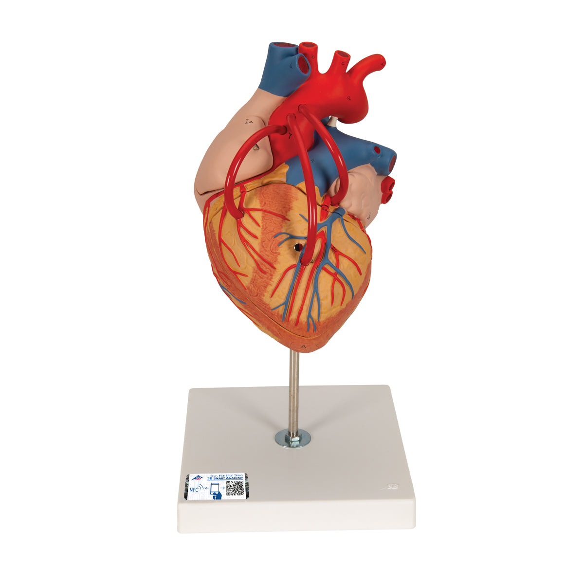 Forstørret hjertemodel der viser resultatet efter en bypass-operation