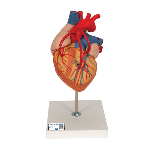 Förstorad hjärtmodell som visar resultatet efter bypassoperation