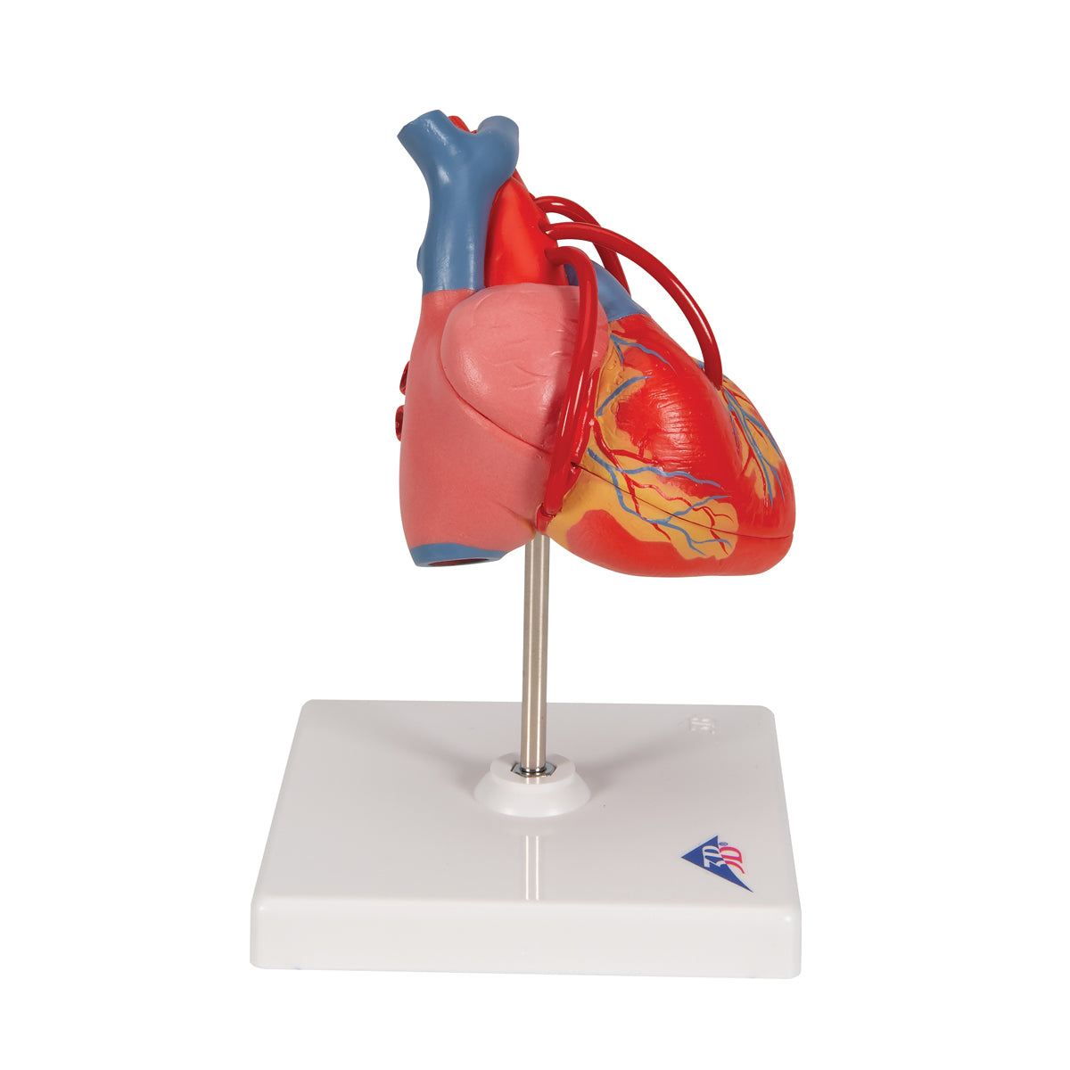 Hjertemodel der viser resultatet efter en bypass-operation