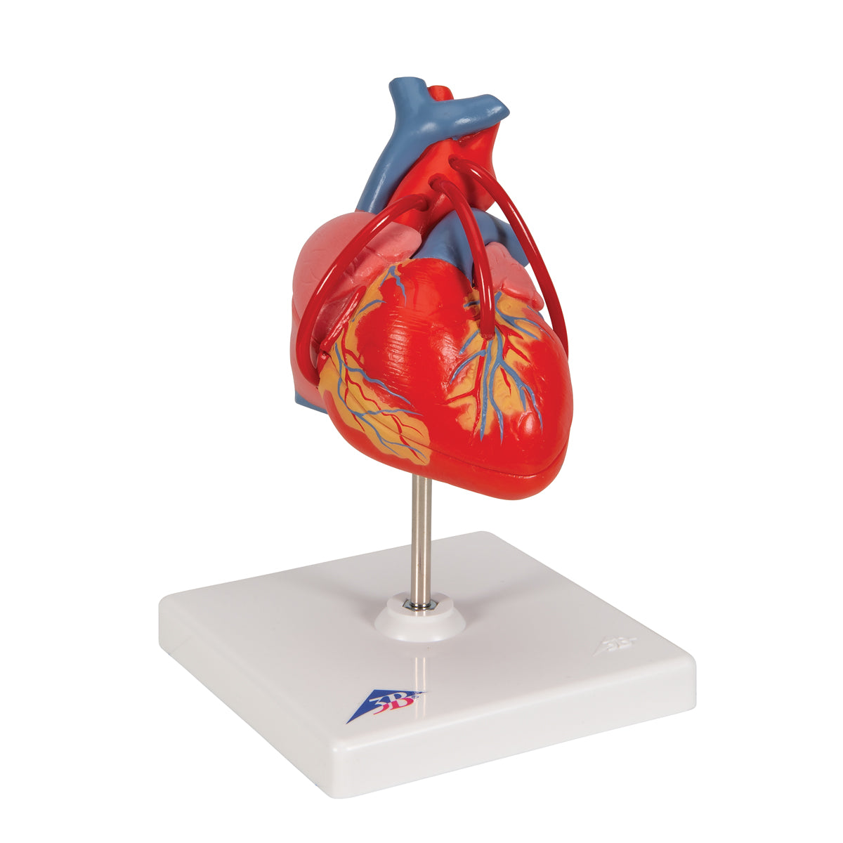 Hjärtmodell som visar resultatet efter en bypass-operation