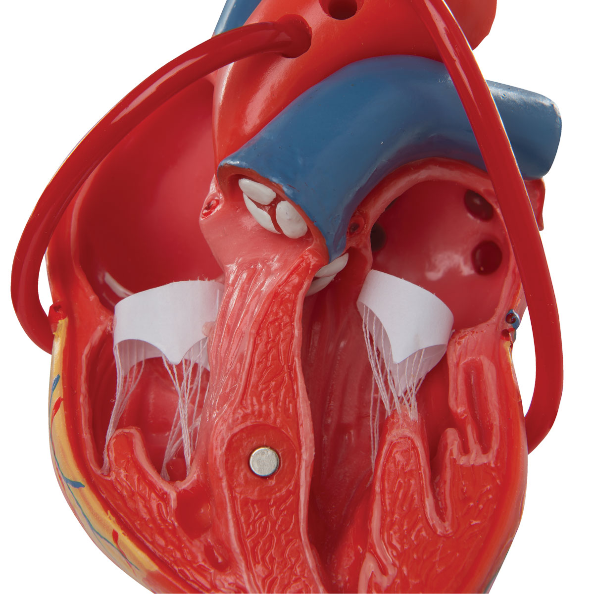 Hjertemodel der viser resultatet efter en bypass-operation