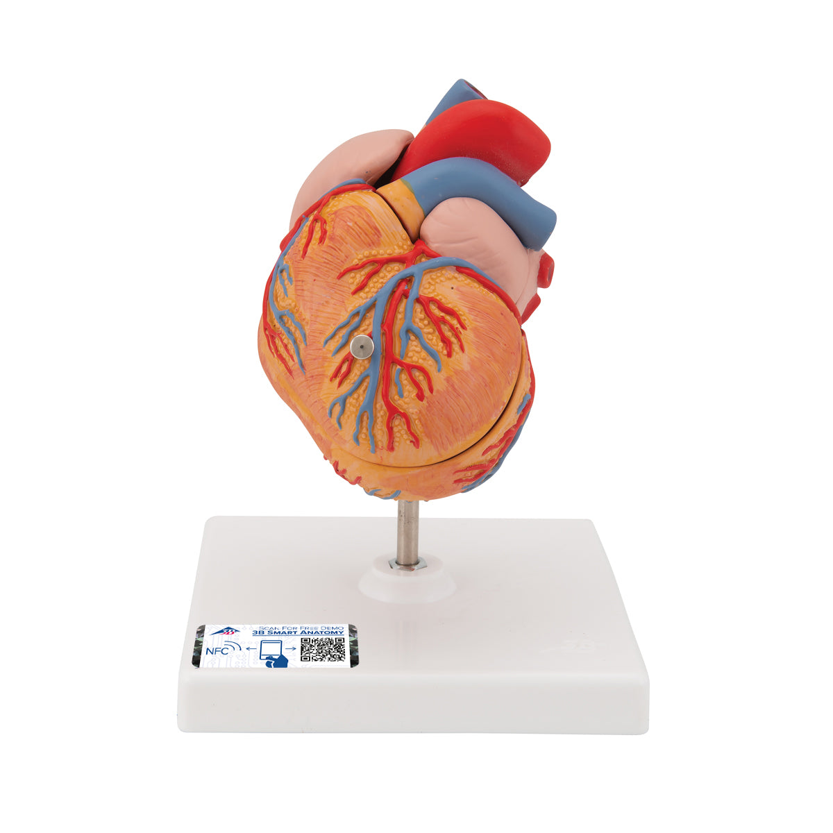 Minskad hjärtmodell med vänsterkammarhypertrofi och stam