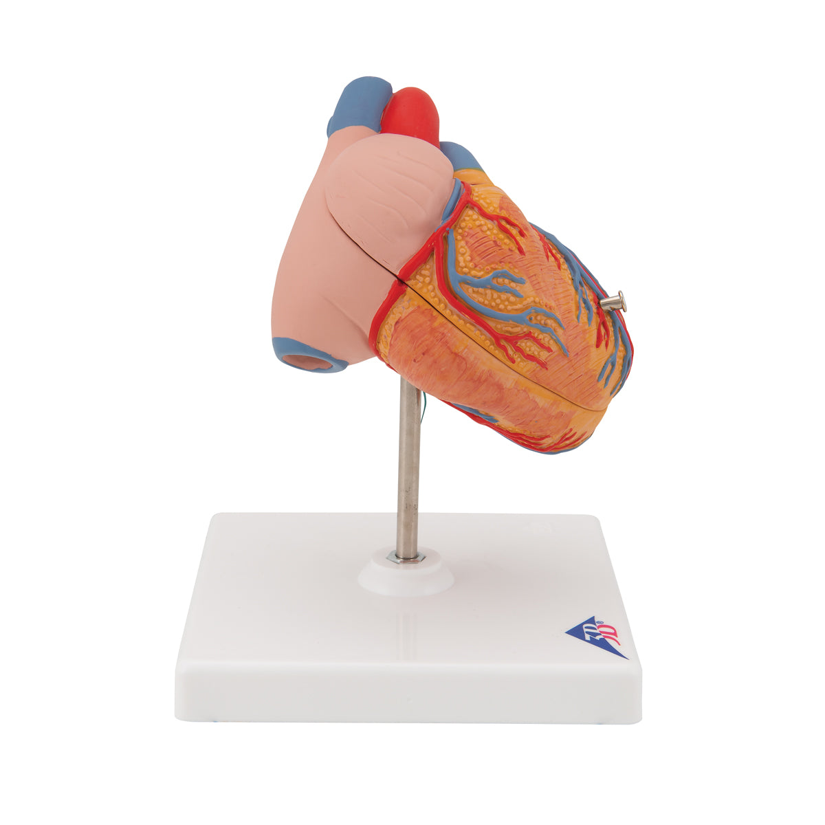 Diminished heart model with left ventricular hypertrophy and strain
