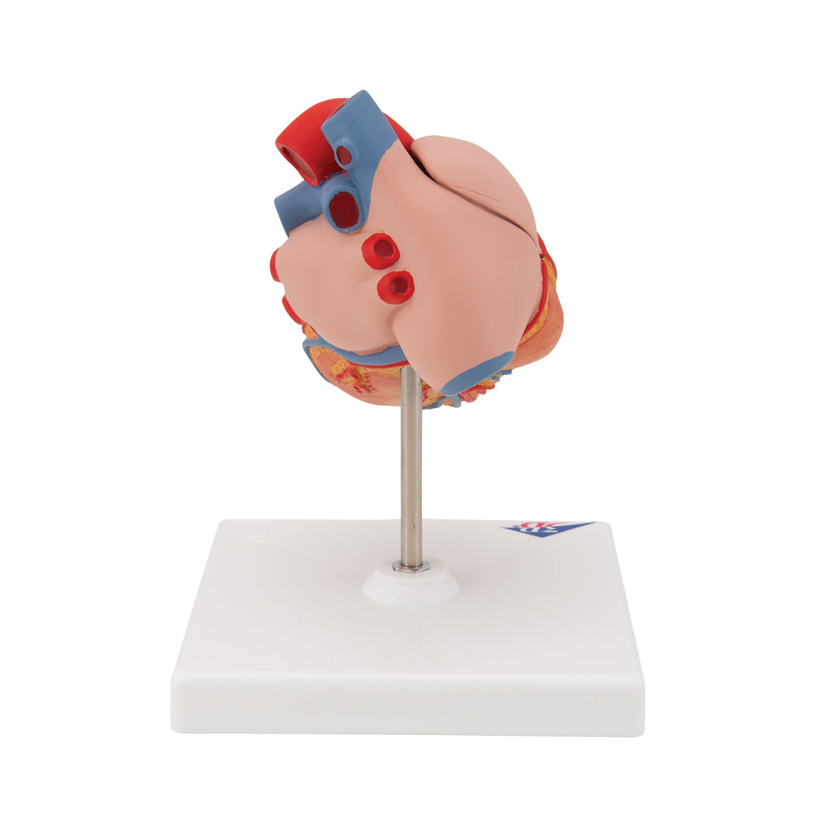 Diminished heart model with left ventricular hypertrophy and strain