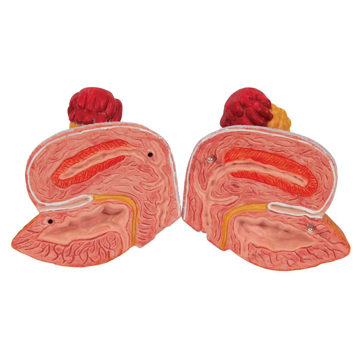 Complete model of the kidneys, ureters and urinary bladder of both sexes