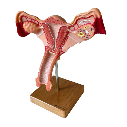 Anatomisk model af kvindens indre kønsorganer