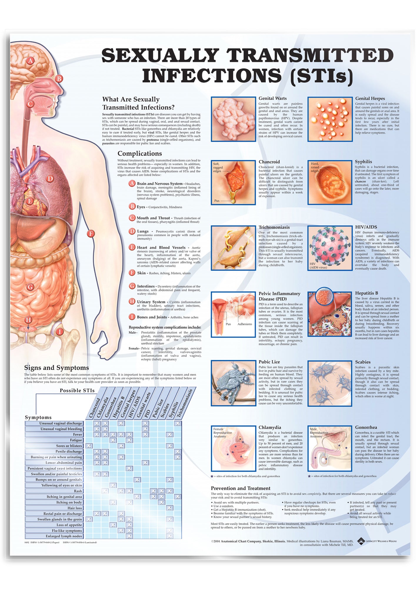 Laminated poster about all the most important venereal diseases with text in English