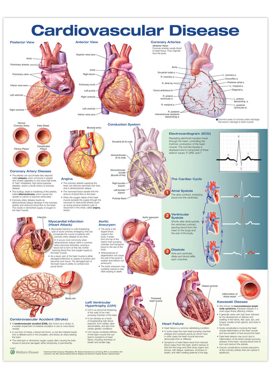 Poster about cardiovascular diseases in English 