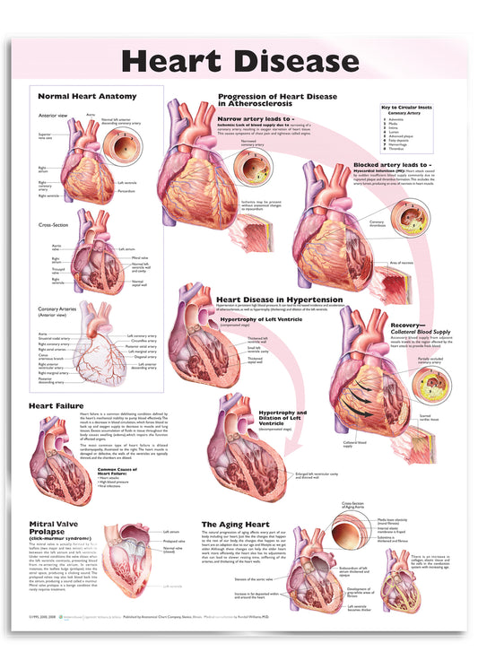 Poster about heart diseases in English