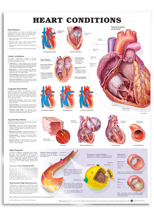 Laminerad affisch om hjärtsjukdomar på engelska 
