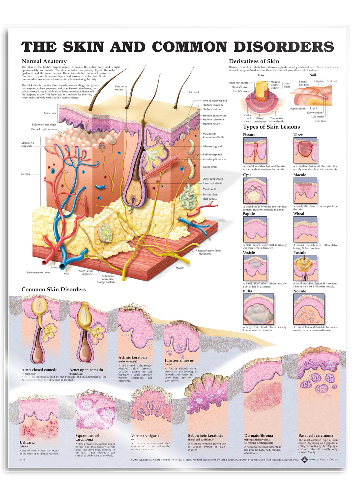 Laminated poster about the skin and common skin disorders in English ...