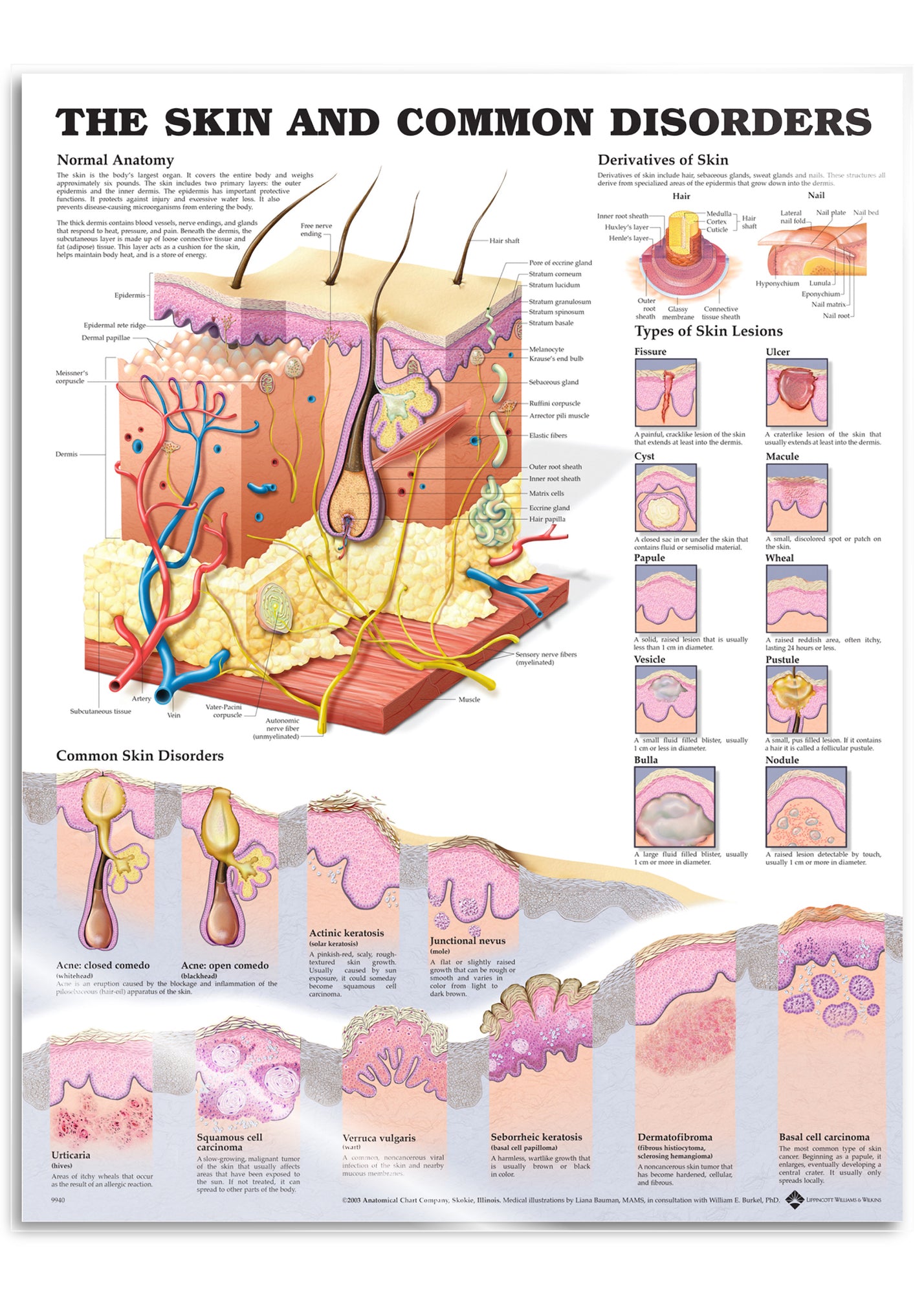 Laminated poster about the skin and common skin disorders in English 