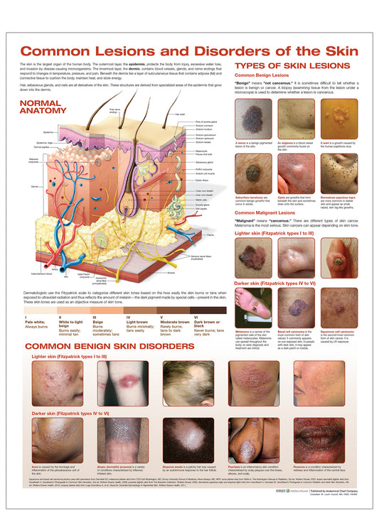 Laminated poster about the skin and common skin disorders in English II