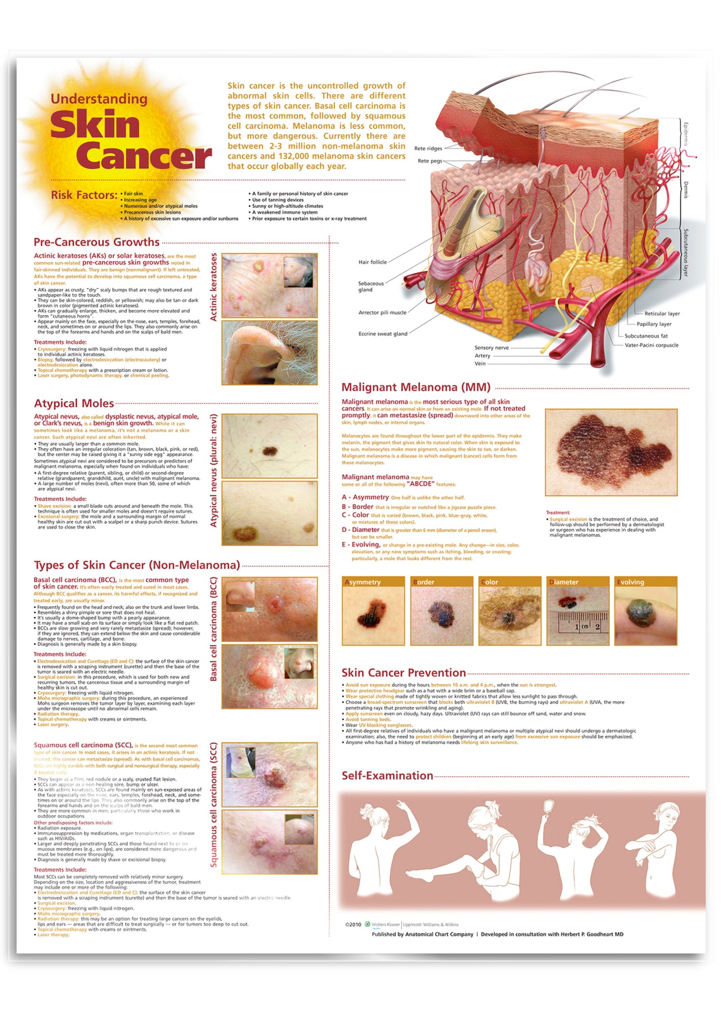Lamineret plakat om hudkræft på engelsk