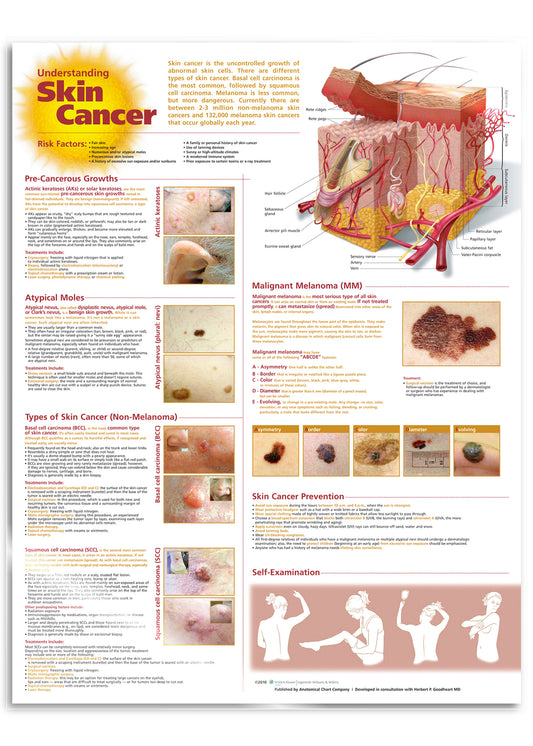 Laminated poster about skin cancer in English