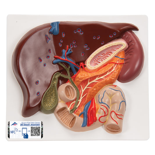 Modell av levern, gallblåsan, gallgångarna och relaterade organ