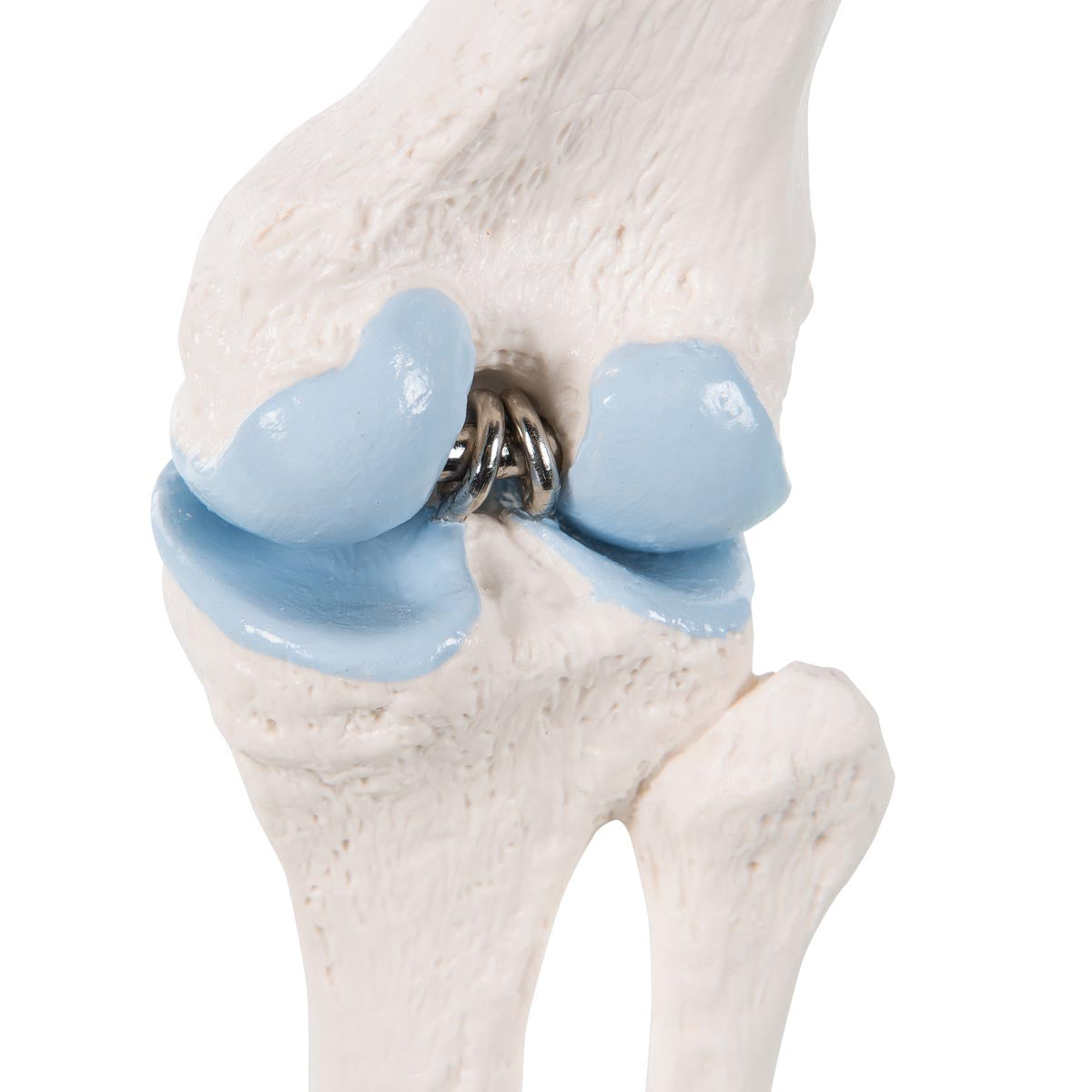 Formindsket knæmodel med farvede ledflader plus et tværsnit af knæleddet
