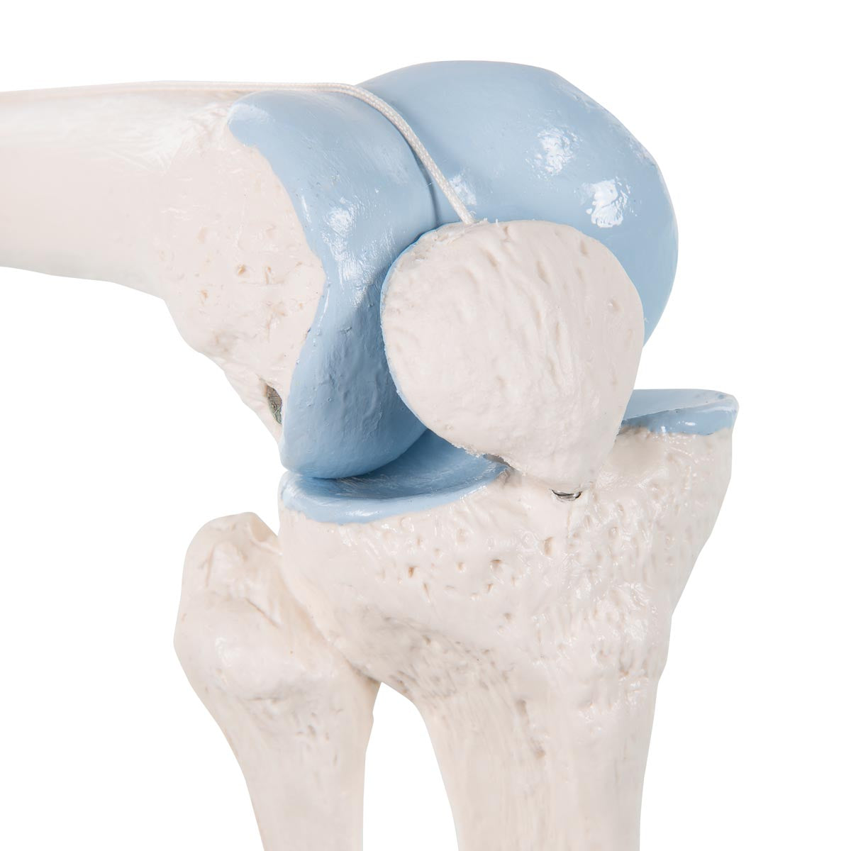 Reduced knee model with colored joint surfaces plus a cross section of the knee joint