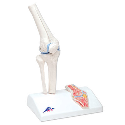 Formindsket knæmodel med farvede ledflader plus et tværsnit af knæleddet