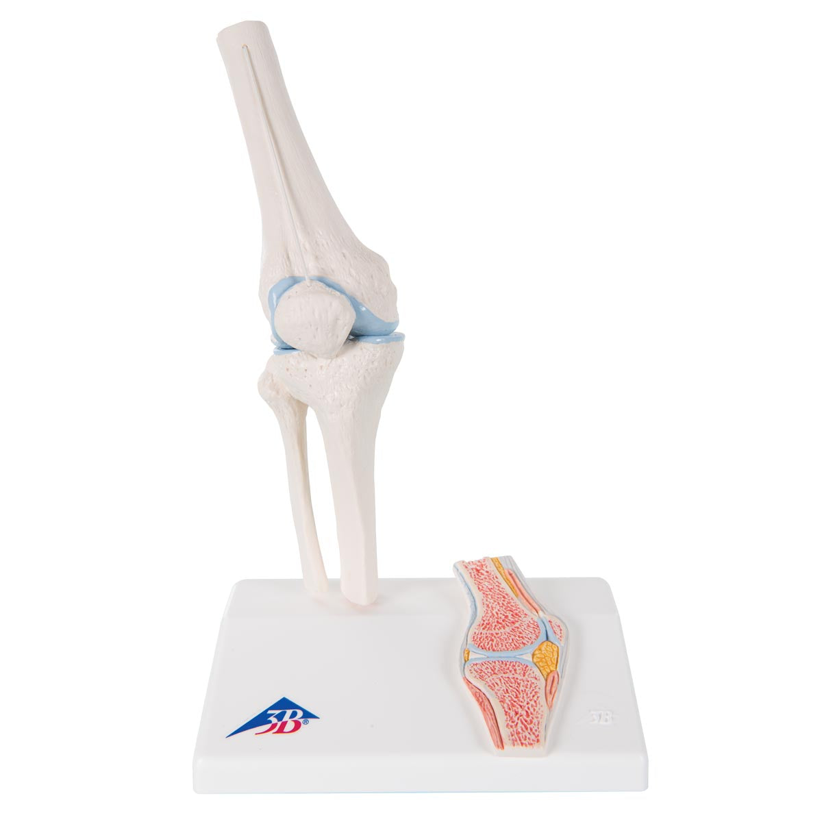 Reduced knee model with colored joint surfaces plus a cross section of the knee joint