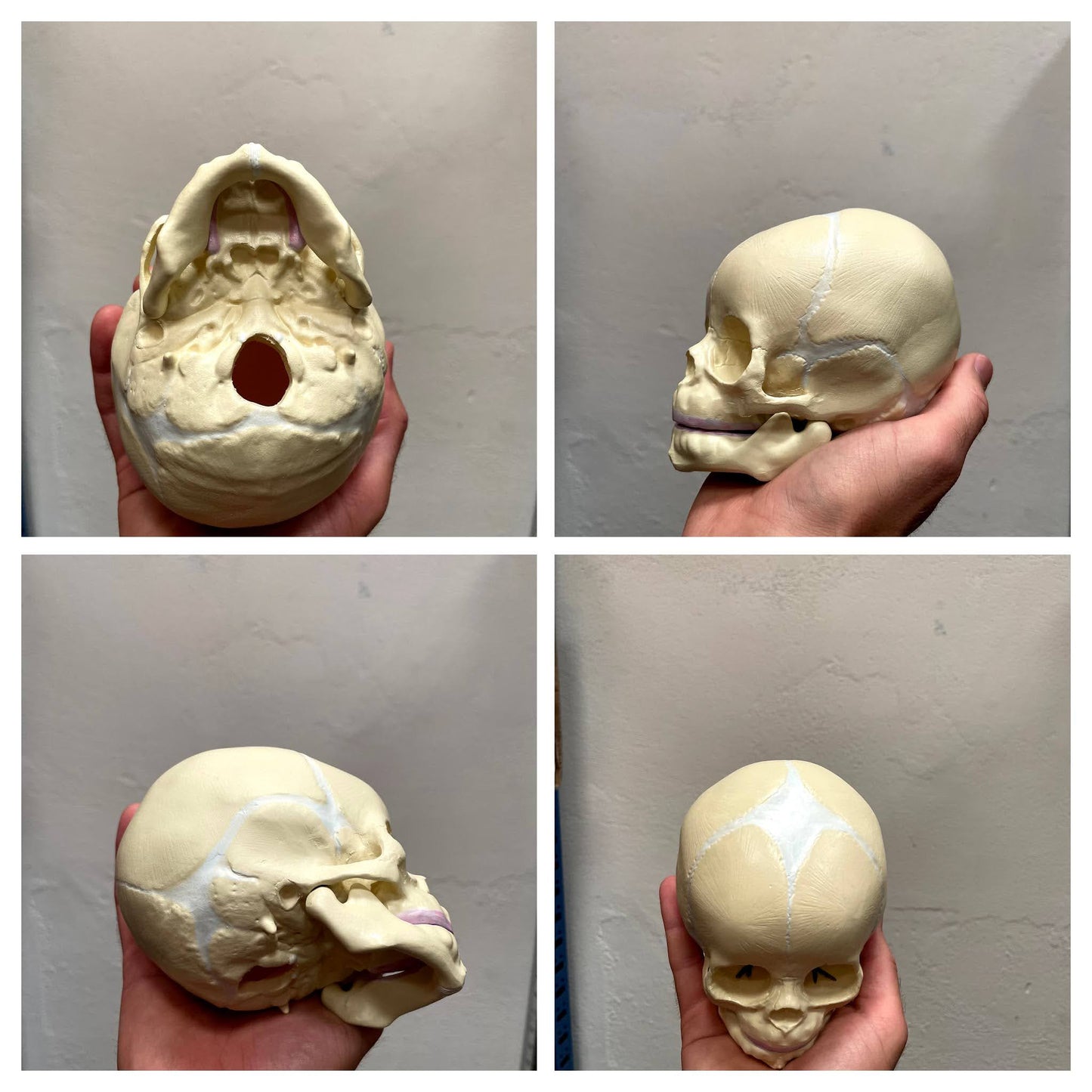 Model of a fetal skull with fontanelles corresponding to pregnancy week 38