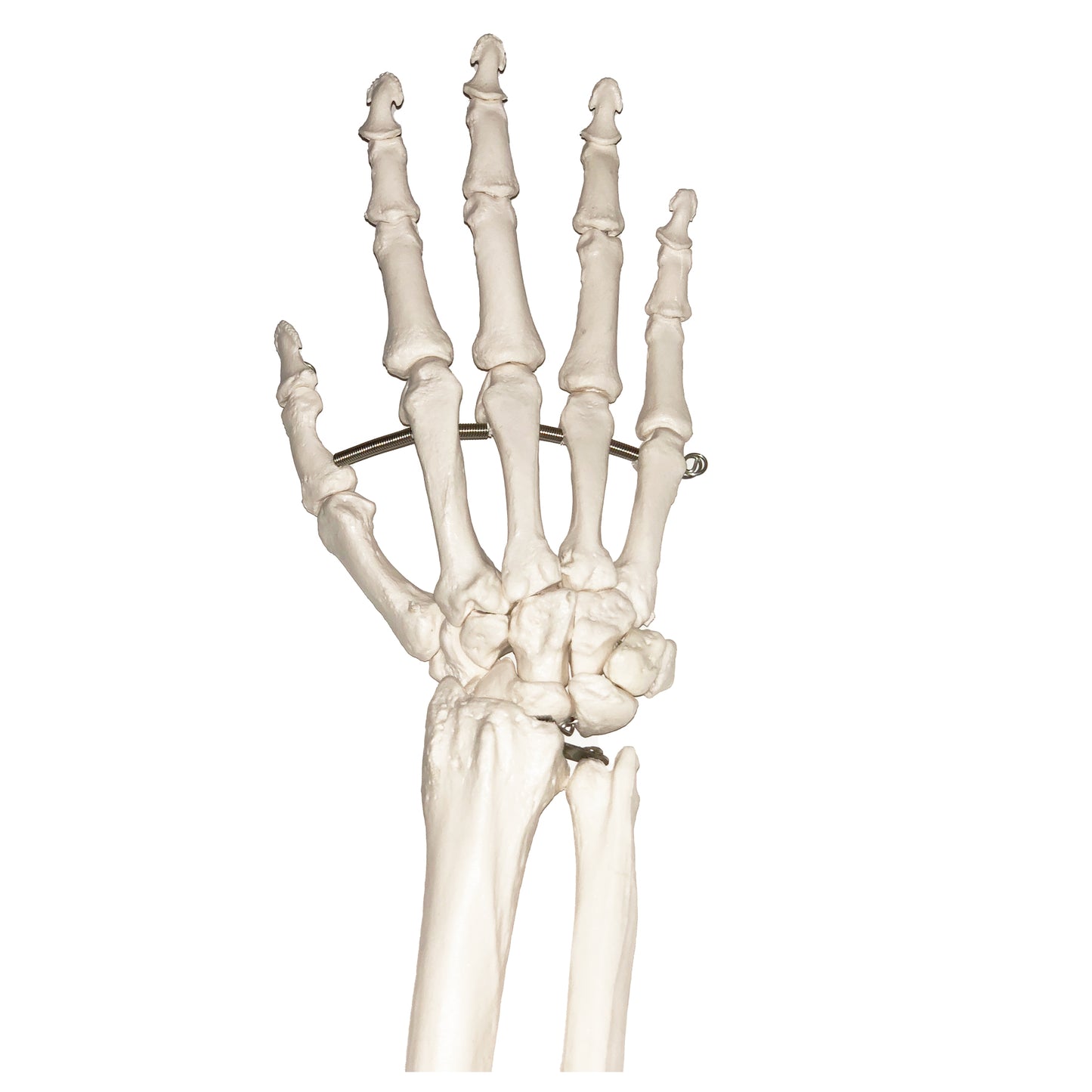 Modell av handens skelett och båda underarmsbenen