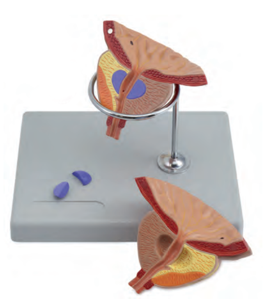Pedagogisk och förstorad modell av prostata (blåshalskörteln), en del av urinröret och en del av urinblåsan