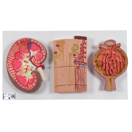 Komplett njurmodell som visar njuren i längdsnitt, nefronet och njurkroppen tillsammans på ett stativ
